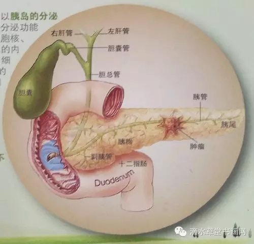 糖尿病的发病原因和解决方案2.webp.jpg
